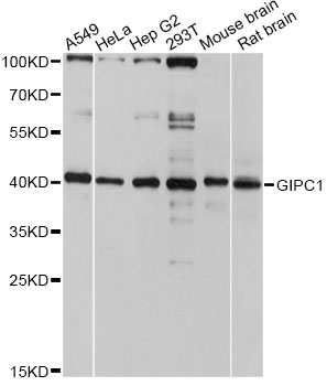 GIPC1 / GIPC Antibody - Western blot analysis of extracts of various cell lines, using GIPC1 antibody at 1:3000 dilution. The secondary antibody used was an HRP Goat Anti-Rabbit IgG (H+L) at 1:10000 dilution. Lysates were loaded 25ug per lane and 3% nonfat dry milk in TBST was used for blocking. An ECL Kit was used for detection and the exposure time was 10s.