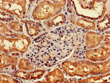 GIPC1 / GIPC Antibody - Immunohistochemistry of paraffin-embedded human kidney tissue at dilution of 1:100