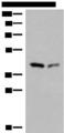 GIPC1 / GIPC Antibody - Western blot analysis of Hela and HEPG2 cell lysates  using GIPC1 Polyclonal Antibody at dilution of 1:400
