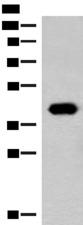 GIPC1 / GIPC Antibody - Western blot analysis of Hela cell lysate  using GIPC1 Polyclonal Antibody at dilution of 1:400