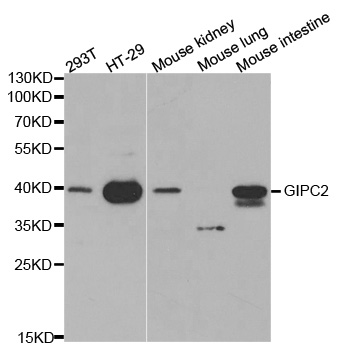 GIPC2 Antibody - Western blot analysis of extracts of various cell lines, using GIPC2 antibody.