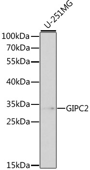 GIPC2 Antibody - Western blot analysis of extracts of various cell lines, using GIPC2 antibody at 1:1000 dilution. The secondary antibody used was an HRP Goat Anti-Rabbit IgG (H+L) at 1:10000 dilution. Lysates were loaded 25ug per lane and 3% nonfat dry milk in TBST was used for blocking. An ECL Kit was used for detection.