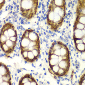 GIPC2 Antibody - Immunohistochemistry of paraffin-embedded human colon using GIPC2 antibodyat dilution of 1:100 (40x lens).