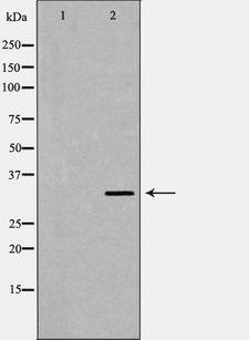 GIPC2 Antibody - Western blot analysis of 293 cell lysates using GIPC2 antibody. The lane on the left is treated with the antigen-specific peptide.