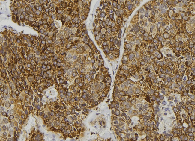 GIPC2 Antibody - 1:100 staining human pancreas tissue by IHC-P. The sample was formaldehyde fixed and a heat mediated antigen retrieval step in citrate buffer was performed. The sample was then blocked and incubated with the antibody for 1.5 hours at 22°C. An HRP conjugated goat anti-rabbit antibody was used as the secondary.
