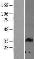 GIPC2 Protein - Western validation with an anti-DDK antibody * L: Control HEK293 lysate R: Over-expression lysate