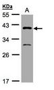 GIPC3 Antibody - Sample (30 ug of whole cell lysate). A: H1299. 10% SDS PAGE. GIPC3 antibody diluted at 1:500