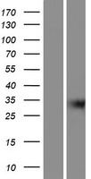 GIPC3 Protein - Western validation with an anti-DDK antibody * L: Control HEK293 lysate R: Over-expression lysate