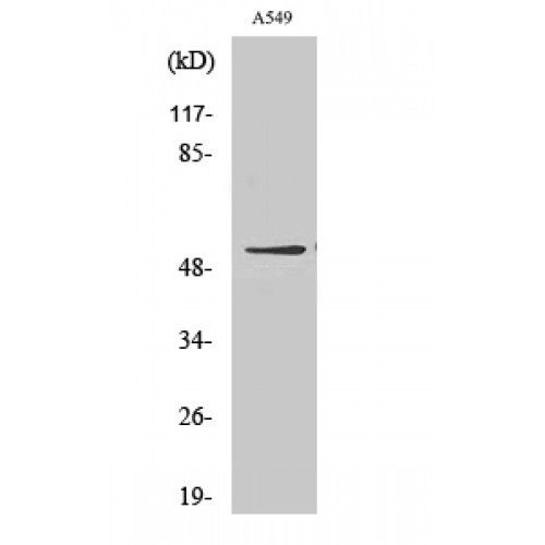 GIPR / GIP Receptor Antibody - Western blot of GIPR antibody