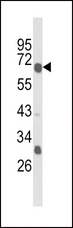 GIPR / GIP Receptor Antibody - Western blot of GIPR Antibody in MDA-MB231 cell line lysates (35 ug/lane). GIPR (arrow) was detected using the purified antibody.