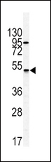 GIPR / GIP Receptor Antibody - Western blot of GIPR antibody in HL60 cell line lysates (35 ug/lane). GIPR (arrow) was detected using the purified antibody.
