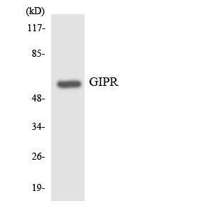 GIPR / GIP Receptor Antibody - Western blot analysis of the lysates from HT-29 cells using GIPR antibody.