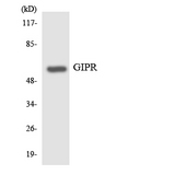 GIPR / GIP Receptor Antibody - Western blot analysis of the lysates from HT-29 cells using GIPR antibody.