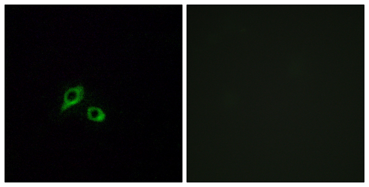 GIPR / GIP Receptor Antibody - Immunofluorescence analysis of MCF7 cells, using GIPR Antibody. The picture on the right is blocked with the synthesized peptide.
