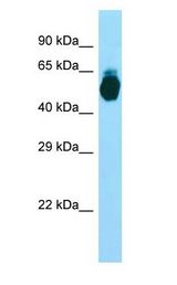 GIPR / GIP Receptor Antibody - GIPR / GIP Receptor antibody Western Blot of 293T cell lysate.  This image was taken for the unconjugated form of this product. Other forms have not been tested.