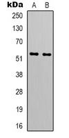 GIPR / GIP Receptor Antibody - Western blot analysis of GIP Receptor expression in HT1080 (A); A549 (B) whole cell lysates.
