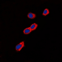 GIPR / GIP Receptor Antibody - Immunofluorescent analysis of GIP Receptor staining in A549 cells. Formalin-fixed cells were permeabilized with 0.1% Triton X-100 in TBS for 5-10 minutes and blocked with 3% BSA-PBS for 30 minutes at room temperature. Cells were probed with the primary antibody in 3% BSA-PBS and incubated overnight at 4 deg C in a humidified chamber. Cells were washed with PBST and incubated with a DyLight 594-conjugated secondary antibody (red) in PBS at room temperature in the dark. DAPI was used to stain the cell nuclei (blue).
