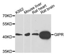 GIPR / GIP Receptor Antibody - Western blot blot of extracts of various cells, using GIPR antibody.