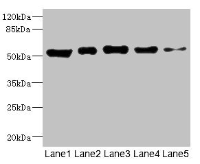 GIPR / GIP Receptor Antibody - Western blot All Lanes: GIPR antibody at 5.89ug/ml Lane 1: Rat heart tissue Lane 2: Mouse brain tissue Lane 3: Hela whole cell lysate Lane 4: A549 whole cell lysate Lane 5: HL60 whole cell lysate Secondary Goat polyclonal to rabbit IgG at 1/10000 dilution Predicted band size: 54,49,50 kDa Observed band size: 53 kDa