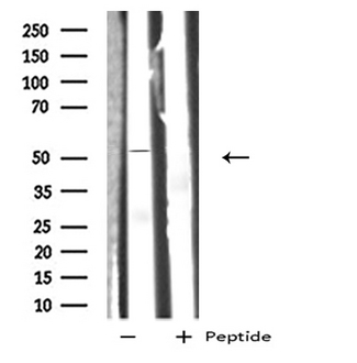GIPR / GIP Receptor Antibody - Western blot analysis GIPR using HT29 whole cells lysates