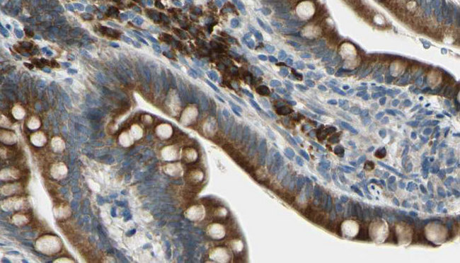 GIPR / GIP Receptor Antibody - 1:100 staining mouse intestine tissue by IHC-P. The sample was formaldehyde fixed and a heat mediated antigen retrieval step in citrate buffer was performed. The sample was then blocked and incubated with the antibody for 1.5 hours at 22°C. An HRP conjugated goat anti-rabbit antibody was used as the secondary.