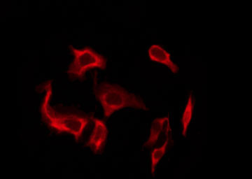GIPR / GIP Receptor Antibody - Staining A549 cells by IF/ICC. The samples were fixed with PFA and permeabilized in 0.1% Triton X-100, then blocked in 10% serum for 45 min at 25°C. The primary antibody was diluted at 1:200 and incubated with the sample for 1 hour at 37°C. An Alexa Fluor 594 conjugated goat anti-rabbit IgG (H+L) Ab, diluted at 1/600, was used as the secondary antibody.