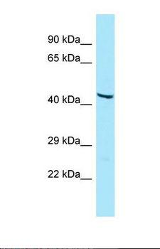 GIPR / GIP Receptor Antibody - Western blot of Human HT1080. GIPR antibody dilution 1.0 ug/ml.  This image was taken for the unconjugated form of this product. Other forms have not been tested.