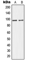 GIT1 Antibody - Western blot analysis of GIT1 expression in HUVEC (A); HeLa (B) whole cell lysates.