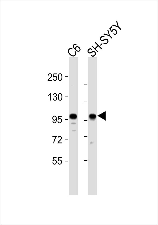 GIT1 Antibody - All lanes : Anti-GIT1 Antibody at 1:4000 dilution Lane 1: C6 whole cell lysates Lane 2: SH-SY5Y whole cell lysates Lysates/proteins at 20 ug per lane. Secondary Goat Anti-Rabbit IgG, (H+L),Peroxidase conjugated at 1/10000 dilution Predicted band size : 84 kDa Blocking/Dilution buffer: 5% NFDM/TBST.