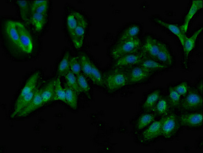 GIT1 Antibody - Immunofluorescent analysis of Hela cells diluted at 1:100 and Alexa Fluor 488-congugated AffiniPure Goat Anti-Rabbit IgG(H+L)