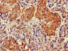 GIT1 Antibody - Immunohistochemistry of paraffin-embedded human pancreatic tissue at dilution of 1:100