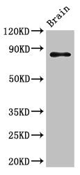 GIT1 Antibody - Western Blot Positive WB detected in:Mouse brain tissue All Lanes:GIT1 antibody at 3.5µg/ml Secondary Goat polyclonal to rabbit IgG at 1/50000 dilution Predicted band size: 85,20,86 KDa Observed band size: 85 KDa