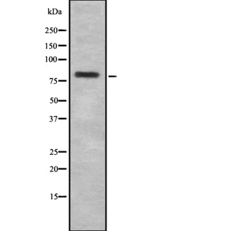 GIT1 Antibody - Western blot analysis GIT1 using HuvEc whole cells lysates