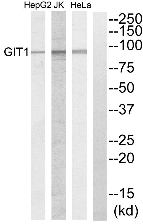 GIT1 Antibody - Western blot analysis of extracts from HeLa cells, Jurkat cells and HepG2 cells, using GIT1 antibody.
