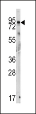 GIT1 Antibody - Western blot of anti-GIT1 Antibody (Y510) in mouse cerebellum tissue lysates (35 ug/lane). GIT1 (arrow) was detected using the purified antibody.