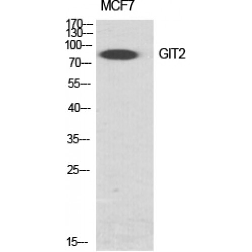 GIT2 Antibody - Western blot of GIT2 antibody