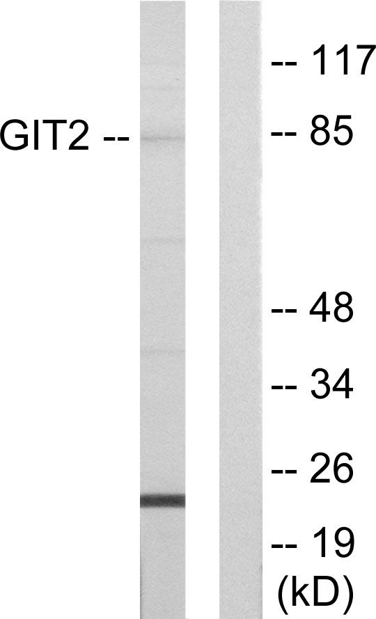 GIT2 Antibody - Western blot analysis of lysates from HepG2 cells, using GIT2 Antibody. The lane on the right is blocked with the synthesized peptide.