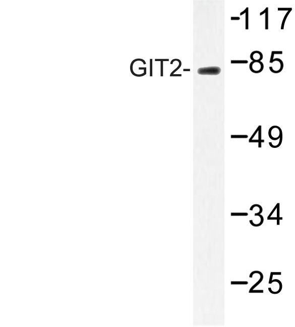 GIT2 Antibody - Western blot of GIT2 (D391) pAb in extracts from HepG2 cells.