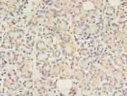 GIT2 Antibody - Immunohistochemistry of paraffin-embedded human pancreatic tissue using antibody at dilution of 1:100.