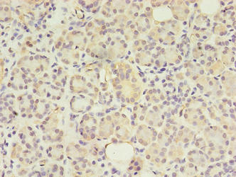 GIT2 Antibody - Immunohistochemistry of paraffin-embedded human pancreatic tissue using GIT2 Antibody at dilution of 1:100