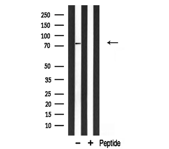 GIT2 Antibody - Western blot analysis of extracts of mouse brain tissue using GIT2 antibody.