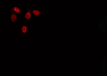 GIT2 Antibody - Staining HepG2 cells by IF/ICC. The samples were fixed with PFA and permeabilized in 0.1% Triton X-100, then blocked in 10% serum for 45 min at 25°C. The primary antibody was diluted at 1:200 and incubated with the sample for 1 hour at 37°C. An Alexa Fluor 594 conjugated goat anti-rabbit IgG (H+L) antibody, diluted at 1/600, was used as secondary antibody.