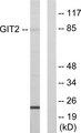 GIT2 Antibody - Western blot analysis of extracts from HepG2 cells, using GIT2 antibody.