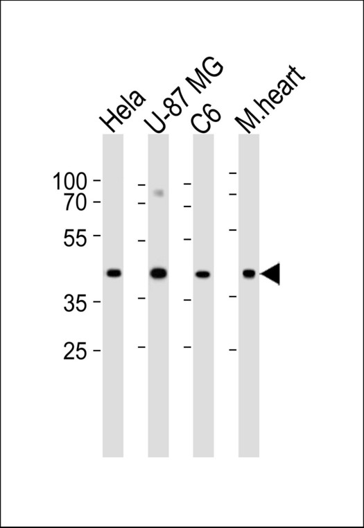 GJA1 / CX43 / Connexin 43 Antibody - Western blot of lysates from HeLa, U-87 MG, C6 cell line and mouse heart tissue lysate (from left to right), using GJA1 Antibody (N121). Antibody was diluted at 1:1000 at each lane. A goat anti-rabbit IgG H&L (HRP) at 1:5000 dilution was used as the secondary antibody. Lysates at 35ug per lane.