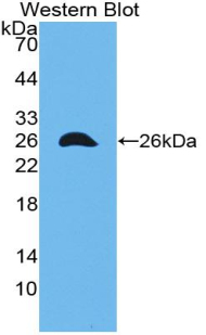 GJA1 / CX43 / Connexin 43 Antibody - Western blot of recombinant GJA1 / CX43 / Connexin 43.