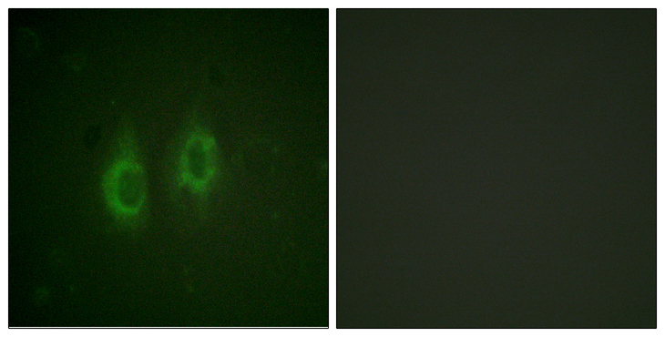 GJA1 / CX43 / Connexin 43 Antibody - Immunofluorescence analysis of HeLa cells, using Connexin 43 Antibody. The picture on the right is blocked with the synthesized peptide.