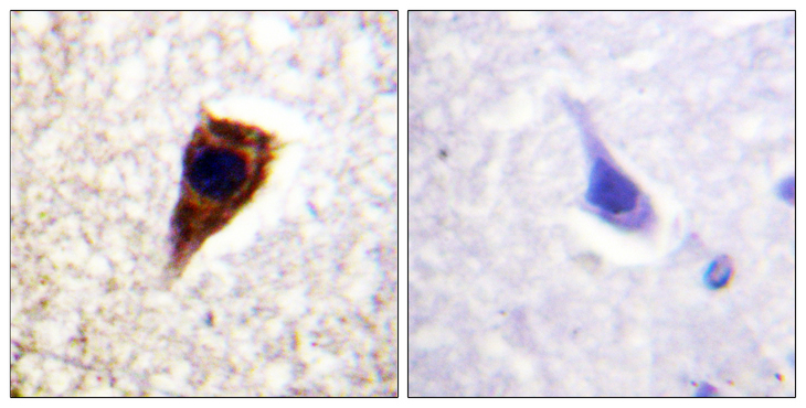 GJA1 / CX43 / Connexin 43 Antibody - Immunohistochemistry analysis of paraffin-embedded human brain tissue, using Connexin 43 Antibody. The picture on the right is blocked with the synthesized peptide.