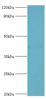 GJA1 / CX43 / Connexin 43 Antibody - Western blot. All lanes: Gap junction alpha-1 protein antibody at 6 ug/ml+HeLa whole cell lysate. Secondary antibody: Goat polyclonal to rabbit at 1:10000 dilution. Predicted band size: 43 kDa. Observed band size: 43 kDa Immunohistochemistry.