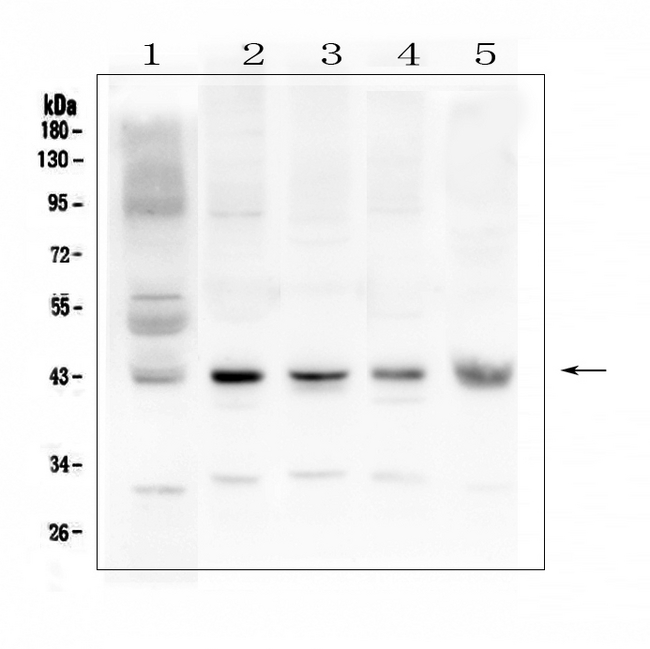 GJA1 / CX43 / Connexin 43 Antibody - Western blot analysis of Connexin 43/GJA1 using anti-Connexin 43/GJA1 antibody. Electrophoresis was performed on a 5-20% SDS-PAGE gel at 70V (Stacking gel) / 90V (Resolving gel) for 2-3 hours. The sample well of each lane was loaded with 50ug of sample under reducing conditions. Lane 1: human placenta tissue lysates, Lane 2: rat brain tissue lysates, Lane 3: rat hear tissue lysates, Lane 4: mouse brain tissue lysates, Lane 5: mouse heart tissue lysates. After Electrophoresis, proteins were transferred to a Nitrocellulose membrane at 150mA for 50-90 minutes. Blocked the membrane with 5% Non-fat Milk/ TBS for 1.5 hour at RT. The membrane was incubated with rabbit anti-Connexin 43/GJA1 antigen affinity purified polyclonal antibody at 0.5 µg/mL overnight at 4°C, then washed with TBS-0.1% Tween 3 times with 5 minutes each and probed with a goat anti-rabbit IgG-HRP secondary antibody at a dilution of 1:10000 for 1.5 hour at RT. The signal is developed using an Enhanced Chemiluminescent detection (ECL) kit with Tanon 5200 system. A specific band was detected for Connexin 43/GJA1 at approximately 43KD. The expected band size for Connexin 43/GJA1 is at 43KD.