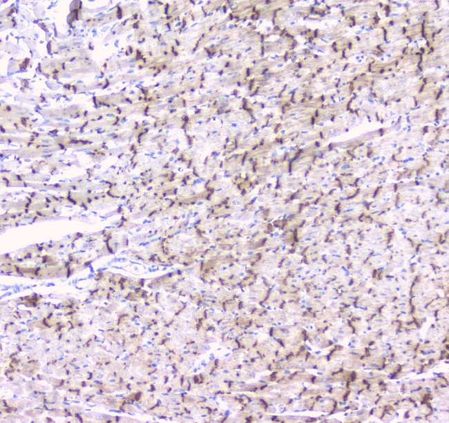 GJA1 / CX43 / Connexin 43 Antibody - IHC analysis of Connexin 43/GJA1 using anti-Connexin 43/GJA1 antibody. Connexin 43/GJA1 was detected in paraffin-embedded section of rat cardiac muscle tissues. Heat mediated antigen retrieval was performed in citrate buffer (pH6, epitope retrieval solution) for 20 mins. The tissue section was blocked with 10% goat serum. The tissue section was then incubated with 1µg/ml rabbit anti-Connexin 43/GJA1 Antibody overnight at 4°C. Biotinylated goat anti-rabbit IgG was used as secondary antibody and incubated for 30 minutes at 37°C. The tissue section was developed using Strepavidin-Biotin-Complex (SABC) with DAB as the chromogen.
